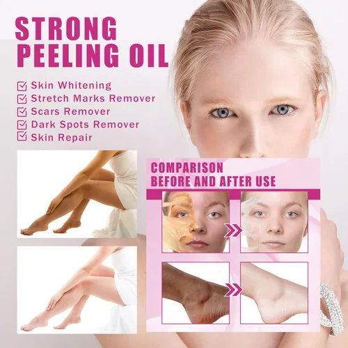 Vista 6 de Aceite de pelado químico extra fuerte amarillo, aceite químico para piel oscura, solución exfoliante para el cuerpo, todo tipo de piel, 3.7 fl