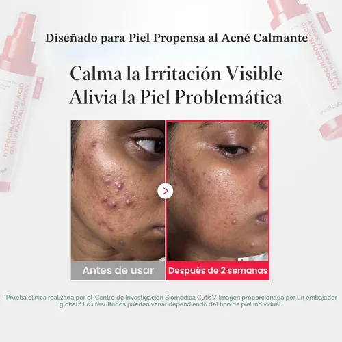Vista 4 de medicube Spray calmante Power Spray de ácido hipocloroso para todo tipo de piel, piel delicada Solución diaria para la piel y cuidado después