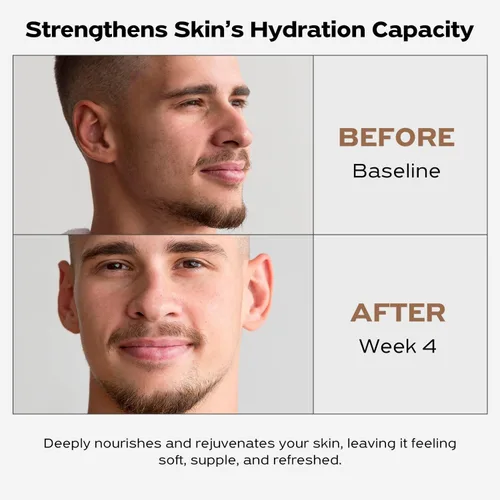 Vista 3 de IGAME - Crema hidratante facial intensiva para pieles grasas Nutritiva e hidratante Hidratante antienvejecimiento Ideal para pieles grasas