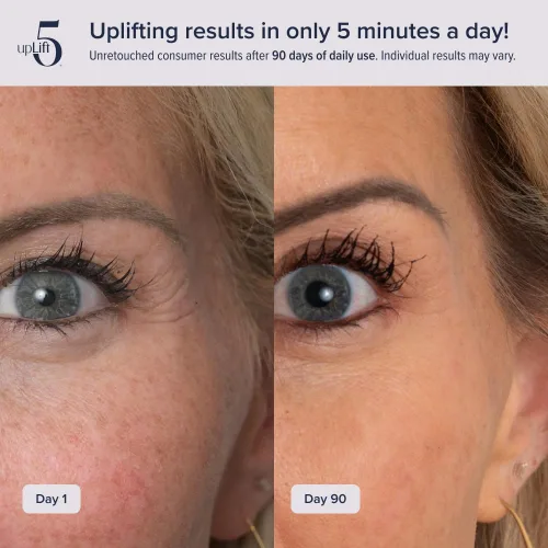 Vista 3 de Elevación facial pulsante Dispositivo de reversión de edad de 5 minutos, contornea y mejora las estructuras faciales, tensando y tonificando