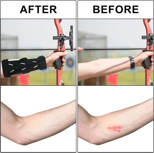 Vista 6 de Protector de brazo de tiro con arco, 1 unidad, ajustable, protector de antebrazo de tiro con arco, ligero, para tiro con arco para arquero cazador