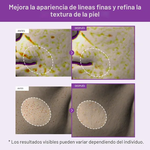 Vista 3 de TOSOWOONG Crema de Noche Real de Retinol 0.1%, Hidratante Facial Anti-Edad con Retinol, Bakuchiol, Piel Más Firme, Reduce Arrugas y Minimiza Poros
