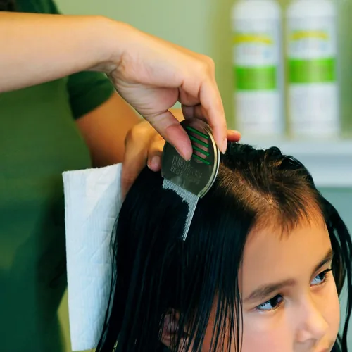 Vista 6 de My Hair Helpers Peine eliminador de piojos – Acero inoxidable – Elimina eficazmente piojos, liendres y superpiojos del cabello – Para 1-2 niños