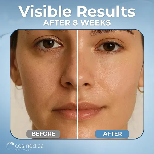 Vista 6 de Cosmedica Skincare Crema hidratante de noche multiactiva, hidratante revitalizante durante la noche y crema antienvejecimiento para cara y cuello