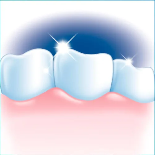 Vista 5 de Ultra Pasta dental blanqueadora avanzada de Brite Reg Size 6z Ultrabrite