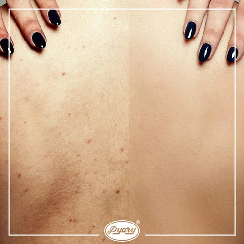 Vista 7 de Barra de jabón de cúrcuma, iluminadora de la piel y eliminación de manchas oscuras, paquete de 2 (5.3 onzas), felicidad facial y corporal, hecha