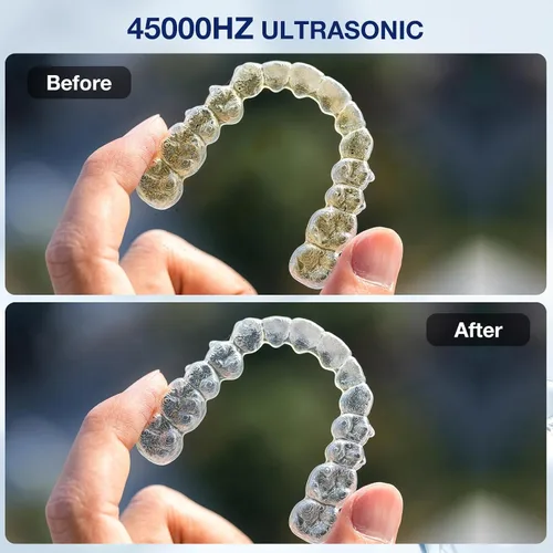 Vista 5 de Máquina limpiadora ultrasónica de retenedores de 45 kHz Limpieza de retenedores 200ML Limpiador dental 4 modos de limpieza con temporizador digital