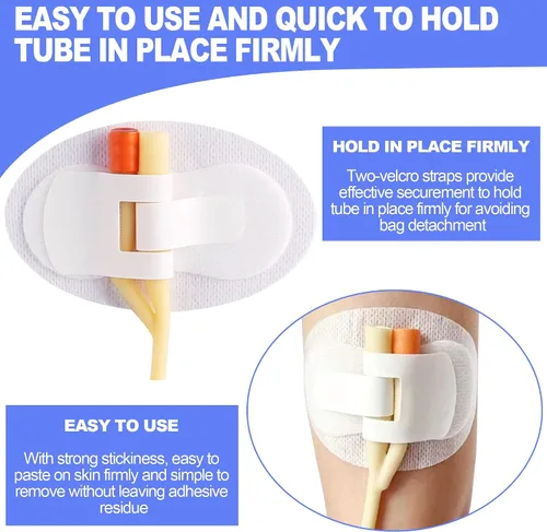 Vista 4 de Foley - Dispositivo de estabilización de catéter (paquete de 5) – Sujeta el tubo individual/doble, el tubo G y el tubo de alimentación en su lugar