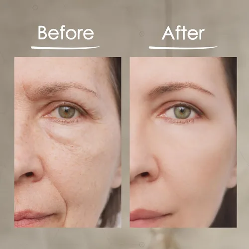 Vista 6 de MaxiLift - Suero de estiramiento facial instantáneo, suero para la piel para la cara y el levantamiento instantáneo de ojos, suave y firme piel