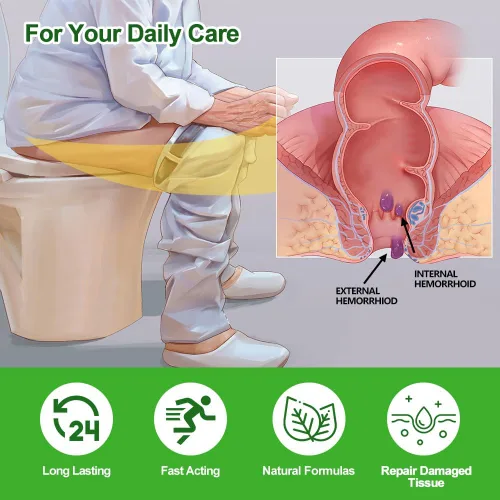 Vista 3 de Crema para hemorroides y fisuras, ungüento hemorroidal para picazón de acción rápida, hinchazón y alivio del dolor de máxima fuerza
