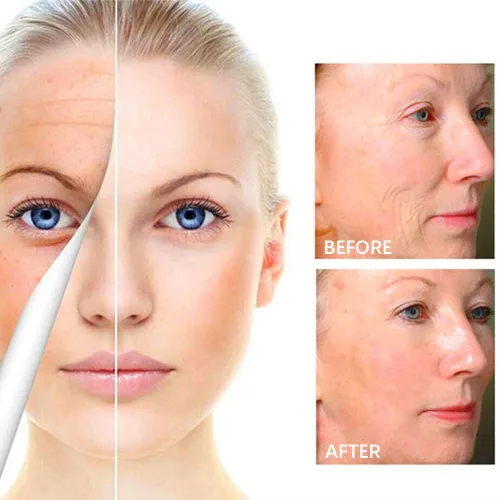 Vista 3 de Crema para Manchas Oscuras en La Cara, Crema para Arrugas, 1.76 oz de proteína de colágeno retinol y ácido hialurónico Crema hidratante facial