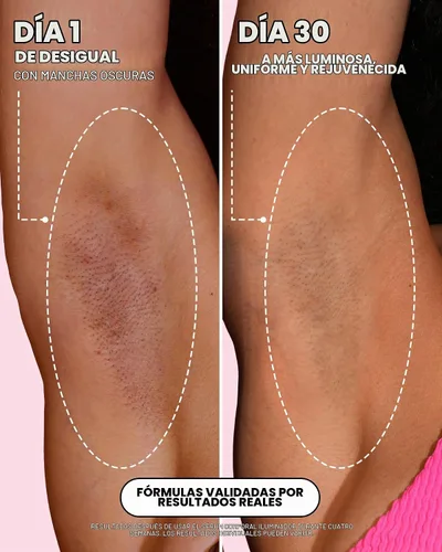 Vista 3 de Truly Suero corporal iluminador de belleza Corrector de manchas oscuras con vitamina C y ácido tranexámico Ayuda a decolorar