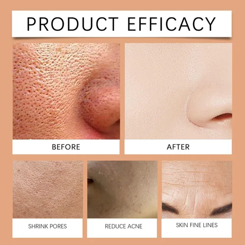 Vista 5 de Gel exfoliante facial, exfoliante facial hidratante con enzima naranja, limpieza profunda, gel exfoliante hidratante de naranja, elimina puntos