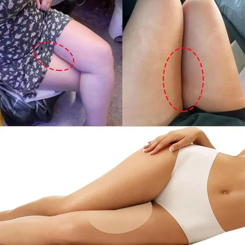 Vista 4 de Almohadillas de cinta de fricción antirozaduras para muslos, parche autoadhesivo para el muslo que evita rozaduras resistente al desgaste