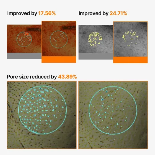 Vista 6 de celimax Máscara de Crema Iluminadora de Poros y Manchas Oscuras 4EA Hoja No Pegajosa para Poros Dilatados con Niacinamida, Ácido Tranexámico, No