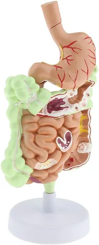 Vista 5 de KESOTO Modelo de Patología Gastrointestinal Humana Modelo Coronal Gástrico del Tracto Digestivo para Estudiantes Escolares Aprendizaje
