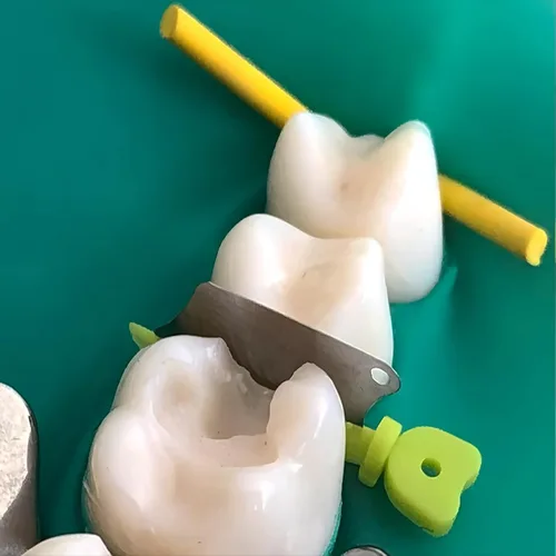 Vista 5 de Cuchillo de cuña dental, sistema de matriz seccional, cuchillo de cuña de plástico interproximal con protección, accesorios de ortodoncia M3 L