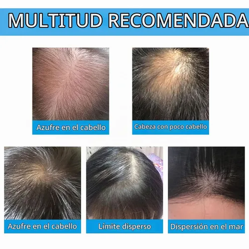 Vista 5 de Fibras de construcción del cabello para adelgazar el cabello con boquilla aplicadora en aerosol, naturales e indetectables, cabello más grueso al