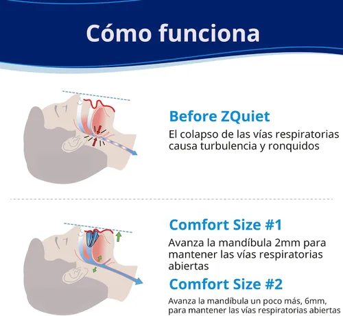 Vista 3 de ZQuiet, Boquilla antironquidos, paquete de inicio con 2 tamaños, bisagra viva y diseño frontal abierto para mayor comodidad y fácil respiración, azul