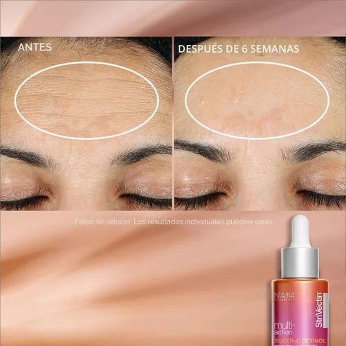 Vista 7 de StriVectin Multi Action Super C Retinol Suero Iluminador y Corrector