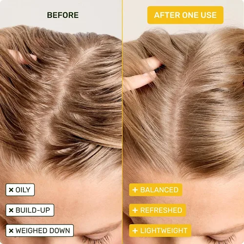 Vista 5 de Ethique Barra de champú clarificante para cabello graso con aceite de ricino, sin plástico, vegano, libre de crueldad, 3.88 onzas, anteriormente St.