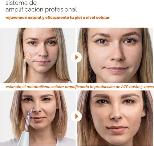 Vista 6 de NuDerma - Varita de terapia profesional para la piel - Máquina portátil de terapia de la piel con 6 varillas de neón y argón – Mejora tu piel