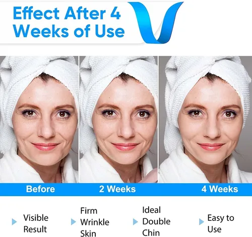 Vista 5 de Máquina reductora de mentón doble, masajeador facial de línea V, masajeador facial de moldeo portátil con luz azul para mejorar el contorno facial
