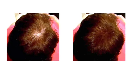 Vista 6 de Solución para cabello ralo - Fibras totalmente naturales a base de plantas para una apariencia más completa y gruesa. Cubre instantáneamente