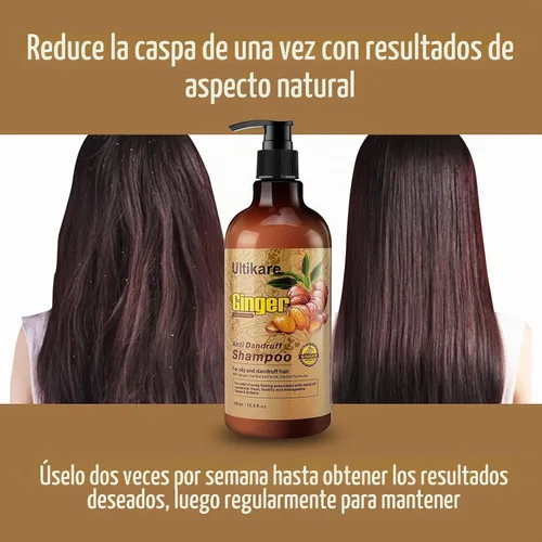 Vista 2 de Champú de jengibre para el cabello caspa, tratamiento anticaspa, champú para el cuidado del cuero cabelludo seco con picazón, aceite de extracto