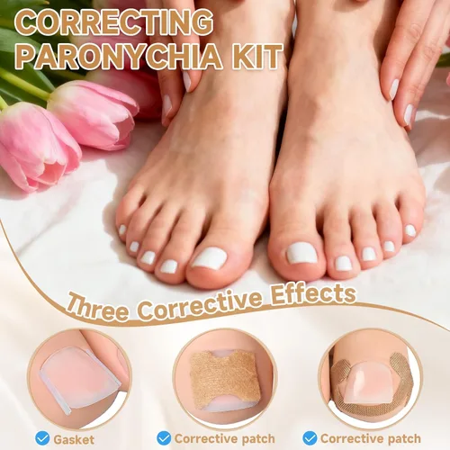 Vista 4 de Kit corrector de uñas encarnadas de 201 piezas con tiras de corrección transpirables, parches de uñas curvas, herramientas levantadoras de uñas