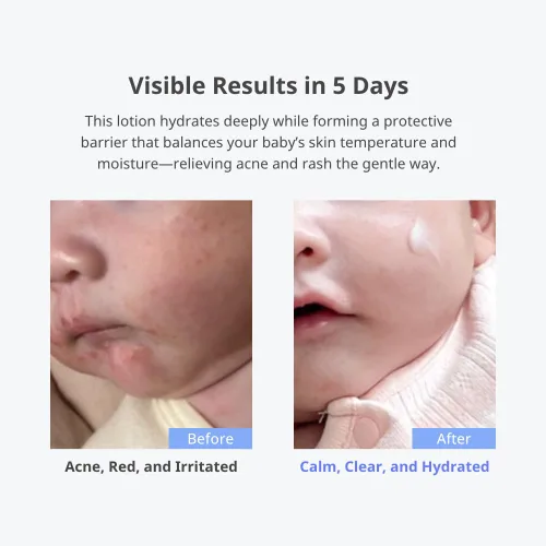Vista 2 de CHA&MOM Korean Baby Skincare - Loción hidratante Phyto Seline hipoalergénica, a base de plantas y natural, 8.46 onzas