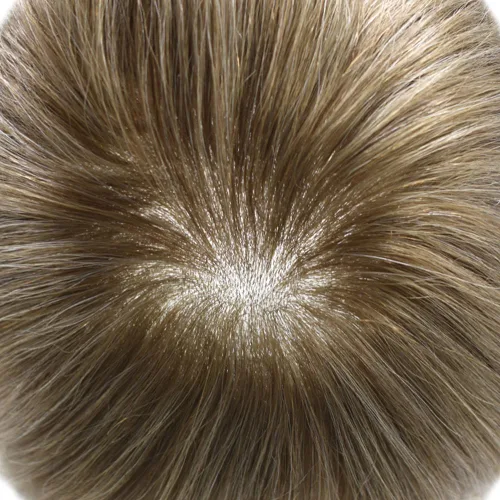 Vista 5 de Toupee - Pieza de cabello humano real, sistema de reemplazo de cabello de piel ultrafina, piezas de cabello tipo tupé, prótesis de cabello con bucle