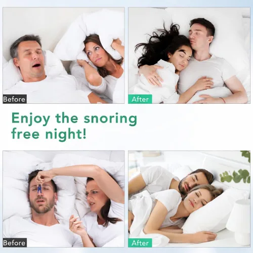 Vista 4 de CINWAUVO Anti ronquidos de ventilación nasal 8 conos nasales dilatador nasal para detener ronquidos eficaz ronquido dispositivos anti ronquidos