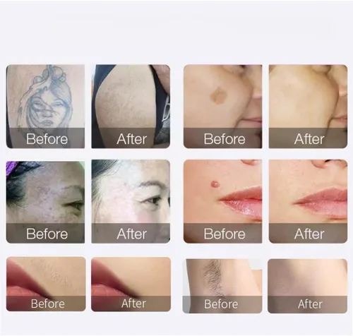 Vista 6 de Dispositivo de depilación y belleza facial 2 en 1
