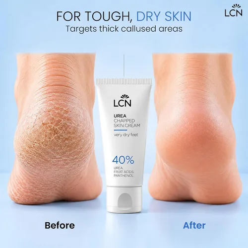 Vista 2 de LCN Crema de piel agrietada de urea 40% para piel gruesa con callos 1.7 fl oz
