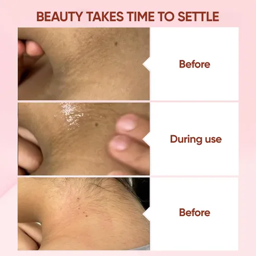 Vista 4 de QUARXERY Gel exfoliante purificador para cara, 2 unidades de gel exfoliante hidratante suave, limpiador exfoliante facial que elimina la piel