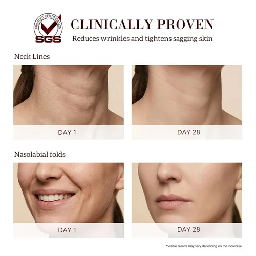 Vista 4 de HKH Suero Bakuchiol Retinol para la cara: 30 cápsulas de suero antienvejecimiento para pieles sensibles - SGS probado para reducir las arrugas en un