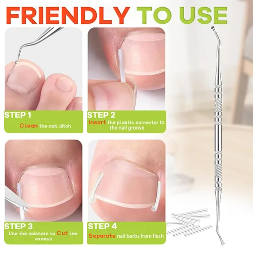 Vista 2 de Kit corrector de uñas encarnadas, herramientas de uñas, tiras de corrección transpirables con herramientas de levantamiento de uñas, cortaúñas