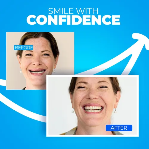 Vista 4 de Prótesis dentales superiores para hervir y morder – Cómodas dentaduras ajustables para reemplazar los dientes perdidos, estilo natural con ajuste