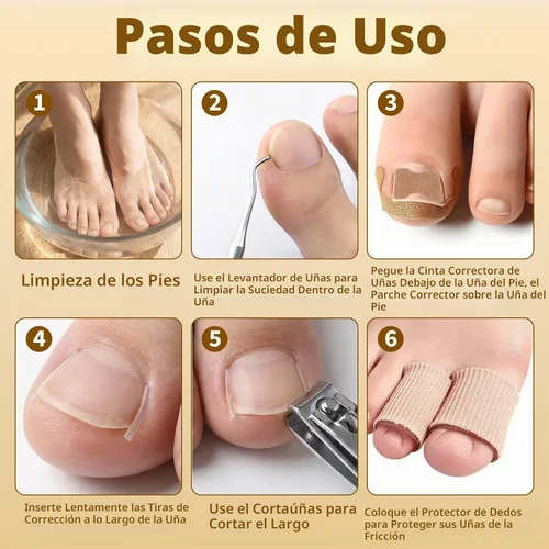 Vista 7 de Juego de corrector de uñas encarnadas con tiras correctoras y lima sin dolor, kit profesional de eliminación de uñas encarnadas con herramienta