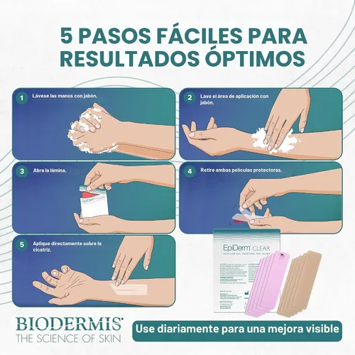 Vista 8 de Epiderm - Tiras de silicona para cicatrices, cinta de silicona reutilizable Transparente (paquete de 5)