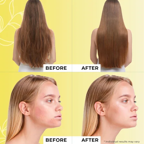Vista 5 de Jeune Naturelle Aceite de jojoba orgánico prensado en frío – 100% puro, crudo, virgen, sin diluir, sin refinar – Ideal para cabello, para la piel