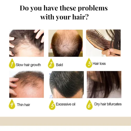 Vista 8 de Gegong Barra de champú, extracto de aloe vera de agua de arroz, ingredientes naturales, tratamiento de pérdida de cabello, control de aceite