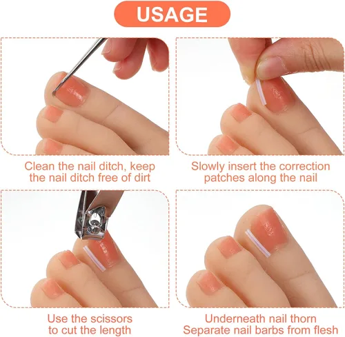 Vista 2 de (50+2) Juego de corrector de uñas encarnadas con cortaúñas, kit profesional de eliminación de uñas encarnadas sin dolor con levantador, tira de uñas