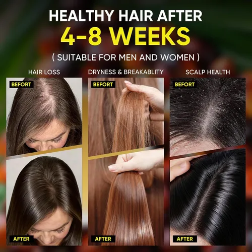Vista 3 de Batana Oil Exfoliante para el crecimiento del cabello, batana orgánica para nutrir el cabello con romero, aceite de cuero cabelludo promueve