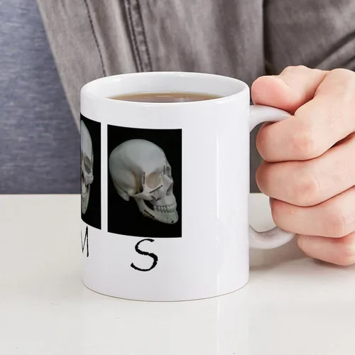 Vista 6 de CafePress OMS - Taza quirúrgica con diseño de calavera de 11 oz (11.0 fl oz)