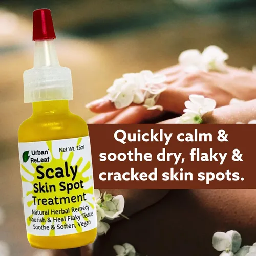 Vista 2 de Urban ReLeaf Tratamiento de manchas de piel escamosa. Aceite reparador suavizante de la piel, alivio natural para manchas escamosas, agrietadas
