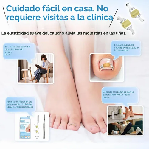 Vista 2 de InhwRior Corrector de uñas encarnadas, fácil aplicación en casa