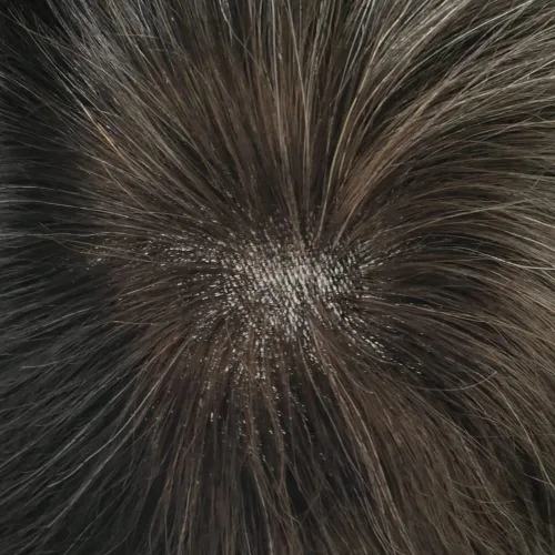Vista 447 de Toupee para hombre 100% cabello humano real tupé para hombres 0.004 in piel de poliuretano para hombre, sistema de reemplazo de piezas de pelo