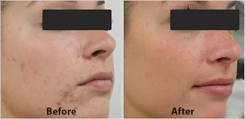 Vista 2 de DNA Code®- Suero de reconstrucción de colágeno complejo de ácido glicólico al 20% con Argireline, Matrixyl 3000, CoQ10